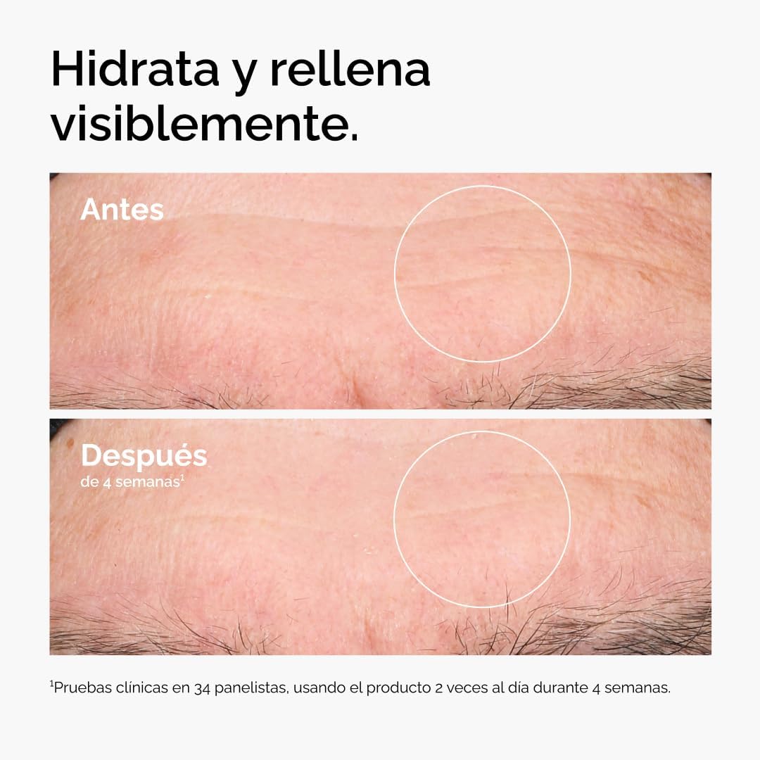 Sérum de Ácido Hialurónico + Crema de Escualano GRATIS