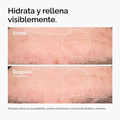 Sérum de Ácido Hialurónico + Crema de Escualano GRATIS